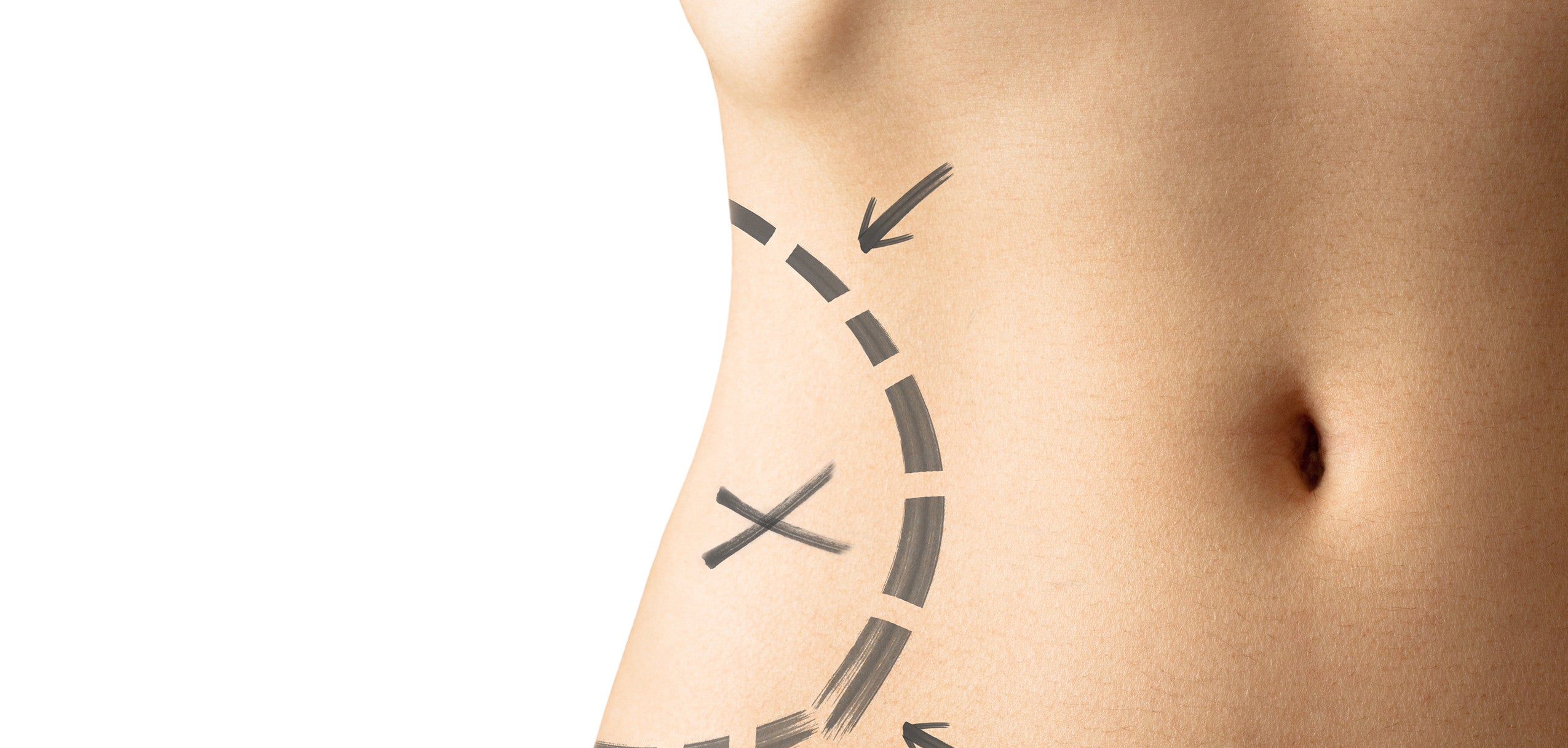 Importance of good compression garment after cosmetic surgeries