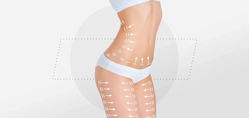 What does a faja do after liposuction? – Shapes Secrets Fajas